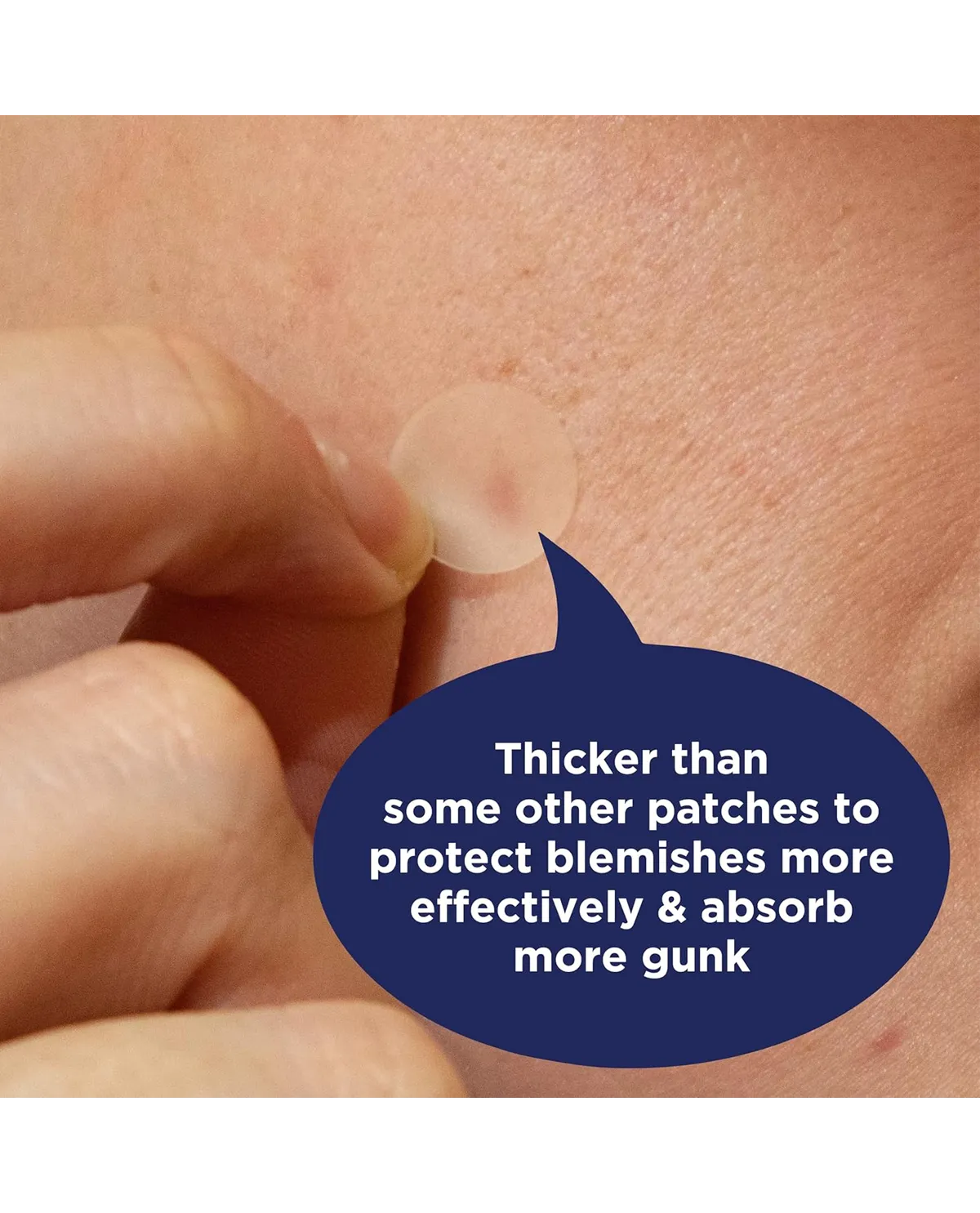 Overnight Spot Patches